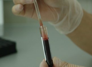 Οι πατέρες περνάνε στα παιδιά γενετικές μεταλλάξεις για σπάνιες ασθένειες