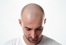 Δεκάδες χιλιάδες αιτήσεις για μεταμόσχευση μαλλιών στην Τουρκία