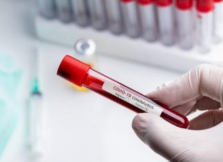 Ιταλία-κορονοϊός: Μικρή αύξηση νέων κρουσμάτων, μείωση νεκρών